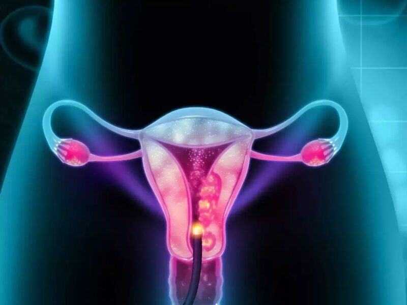 Could a Missed Period Be a Sign of Cervical Cancer